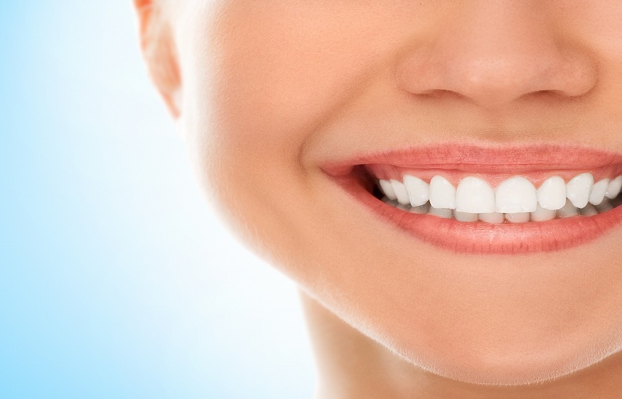 Porcelain Veneers vs Composite Veneers - Which is a better choice? Dental veneers are an effective way to improve your smile. This cosmetic dental treatment covers a range of dental issues such as crooked teeth, misaligned teeth, chipped teeth, discoloured teeth, and so on. Veneers offer a long-lasting smile makeover. The two main types of veneers are Porcelain veneers and Composite veneers. The primary difference between these two veneers is the material from which they are made. The material of the veneer impacts all the other factors such as durability, look and feel, and application procedure. In this blog, we will take a closer look at both composite and porcelain veneers to help you make an informed decision. Porcelain Veneers vs Composite Veneers Porcelain Veneers Made from porcelain, these veneers are custom-made thin shells applied onto your front teeth. These veneers are known for their resistance to stains thereby giving you a dazzling smile. - Porcelain veneers are long-lasting The durability of porcelain veneers is longer than composite veneers. With the right care and maintenance, these veneers can last up to 10 years easily. - Natural appeal Porcelain veneers are thin and translucent which makes them look very natural. Moreover, the veneers are created as per the patient’s tooth shape and size which helps improve the overall smile effortlessly. - No or minimal downtime Porcelain veneers require hardly any downtime. It is a quick procedure and you are almost ready to flash your improved smile once the veneers are placed on your teeth. However, your dentist might suggest a few after-care tips. - Strong Porcelain veneers are quite strong and can are able to bear everyday wear and tear. They are also easy to maintain and care for which makes them preferable. - Can get expensive Porcelain veneers are not extremely cost-effective and people might feel a pinch in their pocket when they opt for these veneers. The porcelain veneer procedure requires 2-3 dentist visits for procedure completion which adds to the overall cost. Composite Veneer Composite veneers are made up of resin. These veneers are added in a layer form to conceal the issues of the tooth. - Application time Composite veneers have a very less application time. The dentist will add resin to your teeth and then cure and polish it. The process is a lot quicker as compared to porcelain veneers. - Durability The durability of composite veneers is 3-5 years, whereas porcelain veneers can last up to 10 years. However, in case of slight damage or crack, composite veneers can be repaired easily but porcelain veneers need to be completely replaced. - The look of the veneer Both composite veneers and porcelain veneers are created to give a natural appeal but porcelain veneers have a more natural look as compared to composite veneers. Additionally, composite veneers are also not very stain resistant. - Cost-effective Composite veneers are affordable as compared to porcelain veneers. They are easy to care for and with regular maintenance can be made to last a bit longer. Dentists suggest porcelain veneers or composite veneers depending on several factors. Make sure you consult a dentist before making a decision. Opt for the minimal prep porcelain veneers and get a sparkling smile.